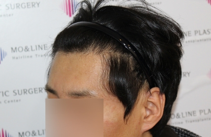 치료후기 이미지